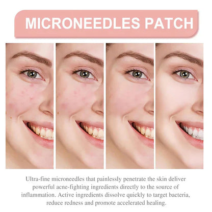 Derma Smooth Skin Tag Removal Patch