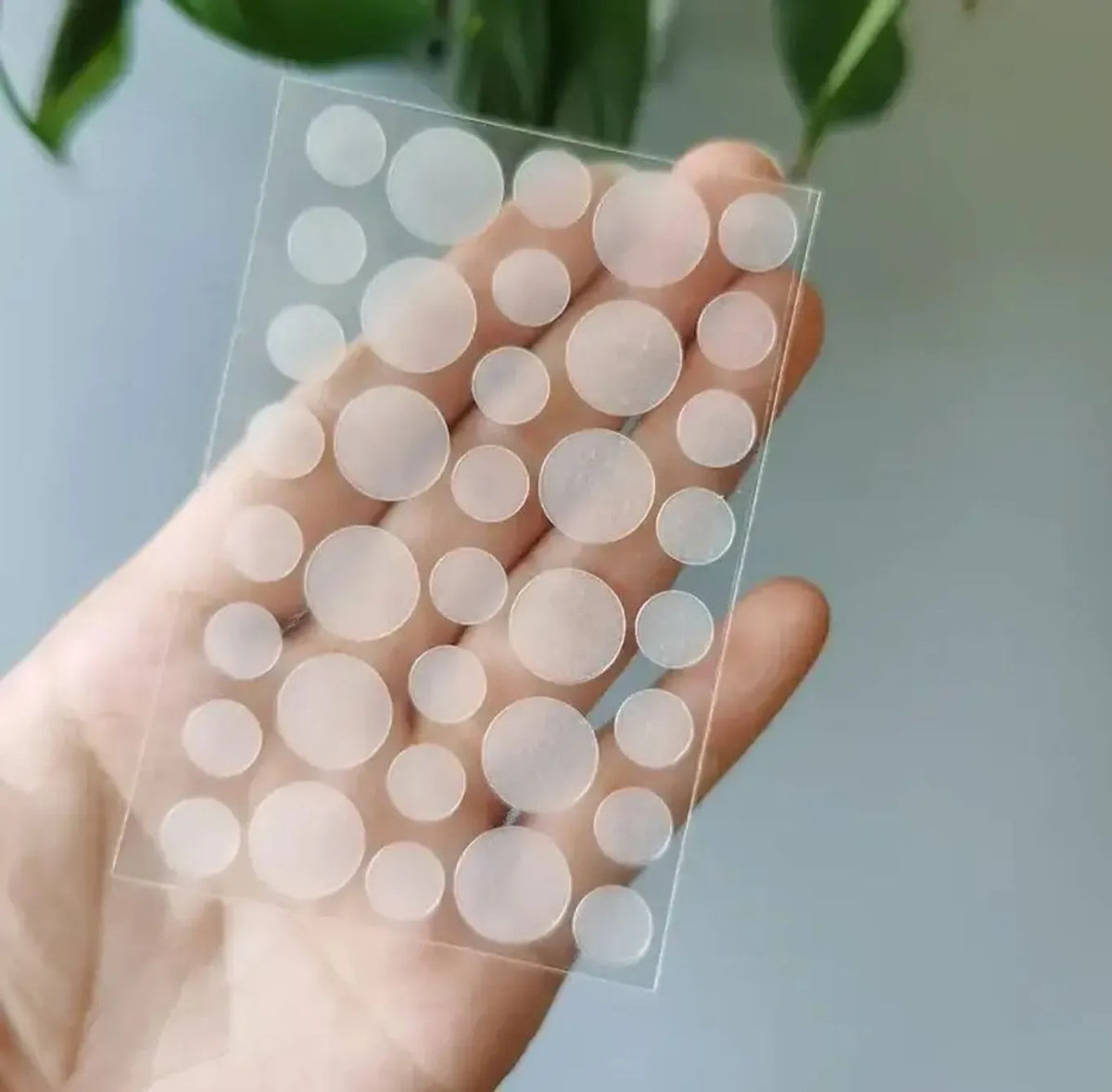 Anti-Acne Hydrocolloid Pimple Patches (36 Pcs) | Invisible Acne Spot Treatment