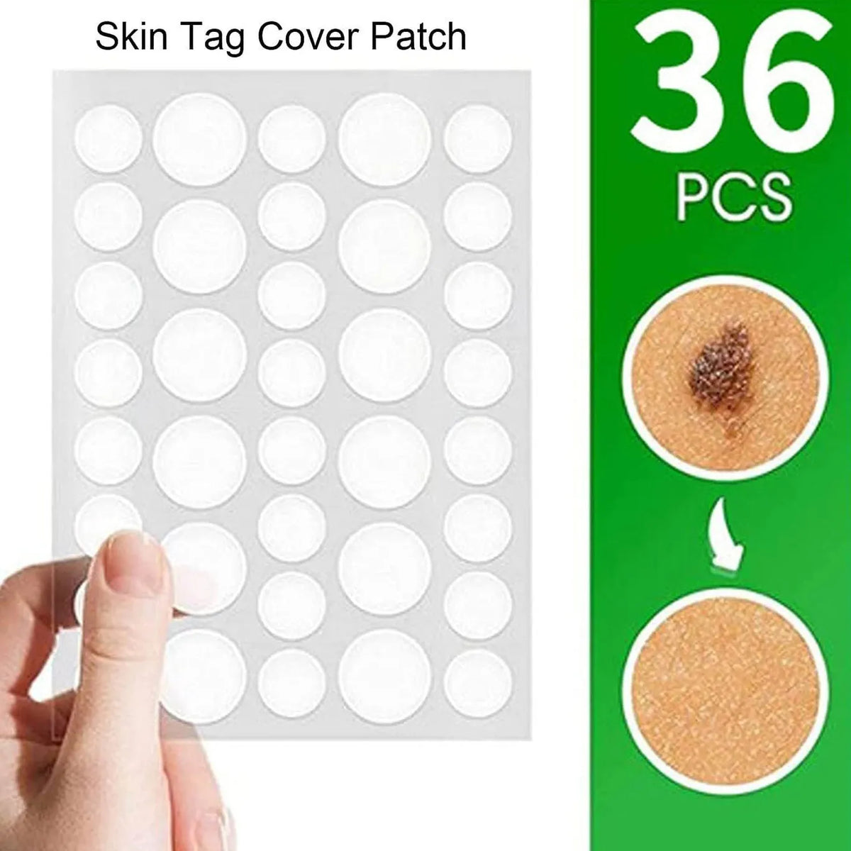 Anti-Acne Hydrocolloid Pimple Patches (36 Pcs) | Invisible Acne Spot Treatment